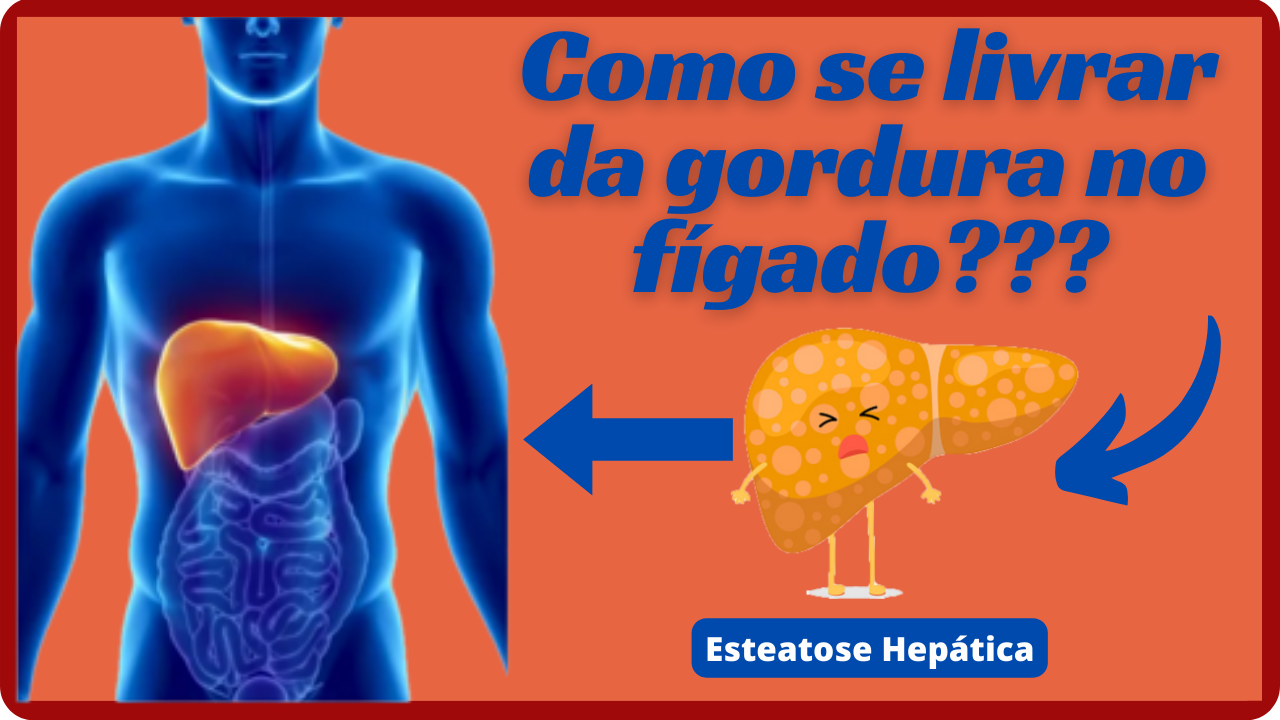 Gordura No FC3ADgado1